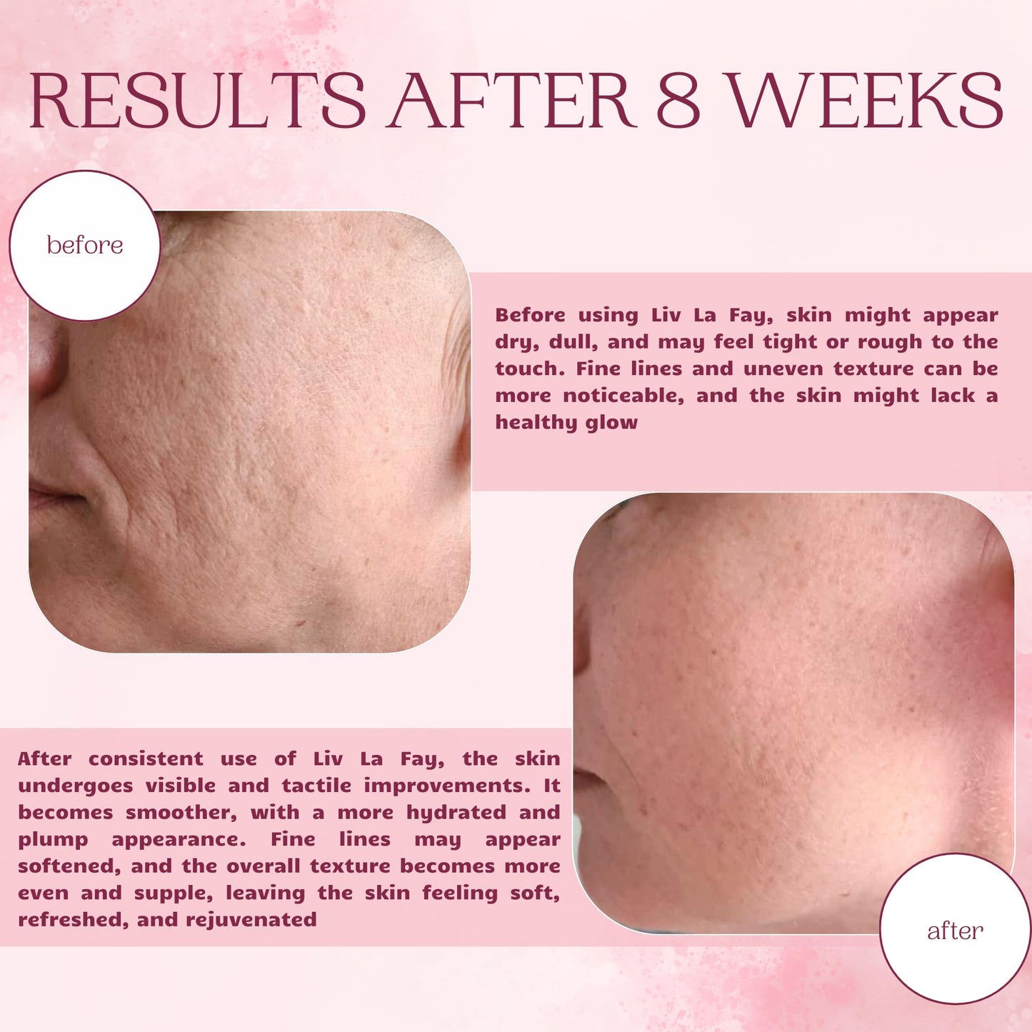 Retinol Moisturiser with SPF30 Most Powerful Anti-Aging Cream with Retinol, Hyaluronic Acid, Ceramide &Vitamin E, B5 for Face & Neck Deep Hydration Day&Night Wrinkle Reduction Liv La Fay Eternal Youth