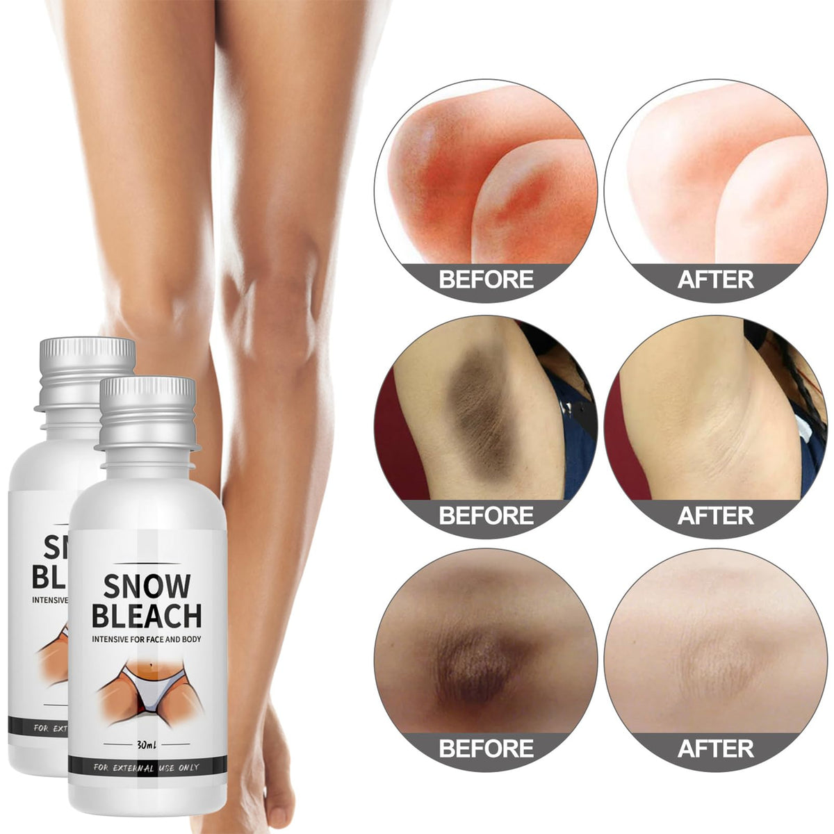 ISBEAUSOLS Snow Bleach Cream 2PCS - Skin Bleaching Cream - Whitening Creams with Centella & Niacinamide - Underarm Whitening Products Effective for Armpit, Knees, Elbows & Knuckles - Skin Lightening Creams