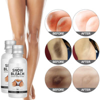 ISBEAUSOLS Snow Bleach Cream 2PCS - Skin Bleaching Cream - Whitening Creams with Centella & Niacinamide - Underarm Whitening Products Effective for Armpit, Knees, Elbows & Knuckles - Skin Lightening Creams