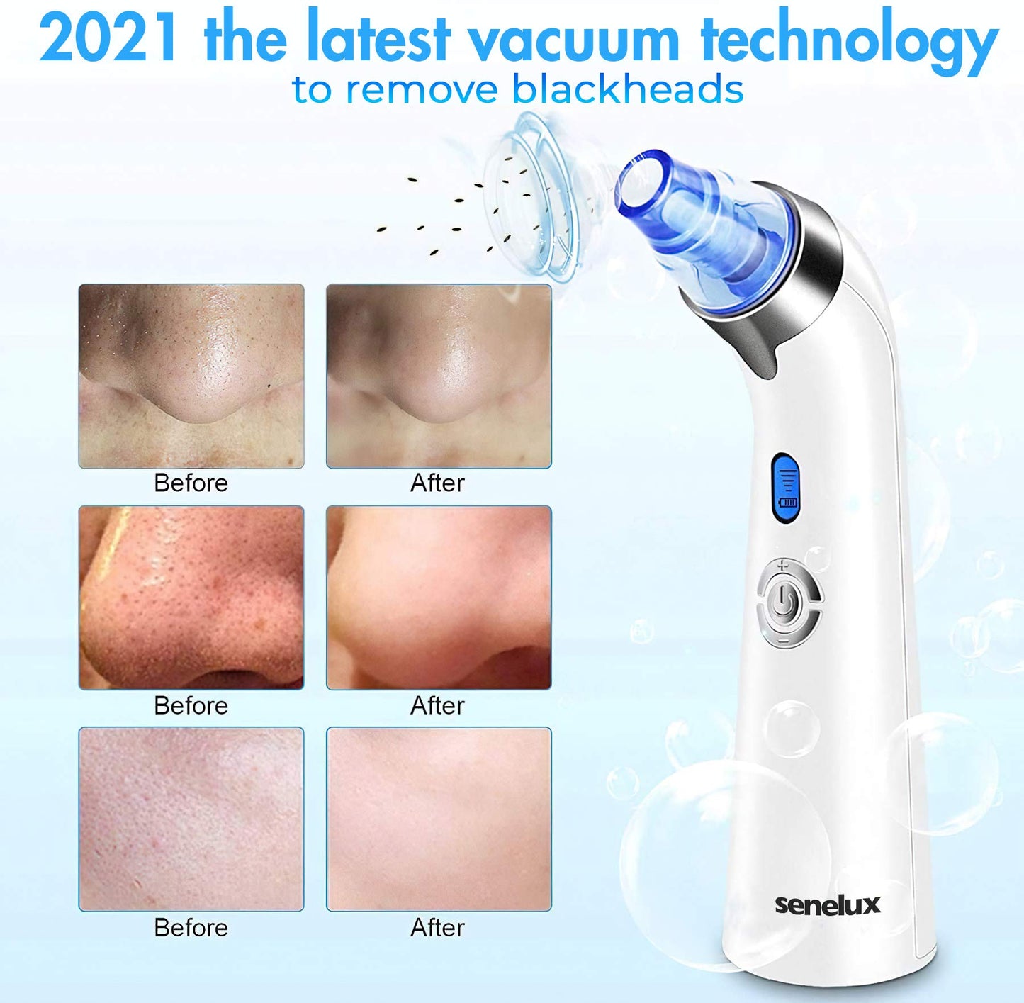 Senua Senelux Blackhead Remover Vacuum Pore Cleaner Acne Comedone Extractor Face Pore Vacuum Blackhead Remover Tool Facial Pore Cleanser with 5 Adjustable Suction Power and 4 Replacement Probes - Blue