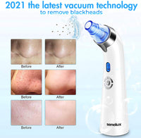 Senua Senelux Blackhead Remover Vacuum Pore Cleaner Acne Comedone Extractor Face Pore Vacuum Blackhead Remover Tool Facial Pore Cleanser with 5 Adjustable Suction Power and 4 Replacement Probes - Blue