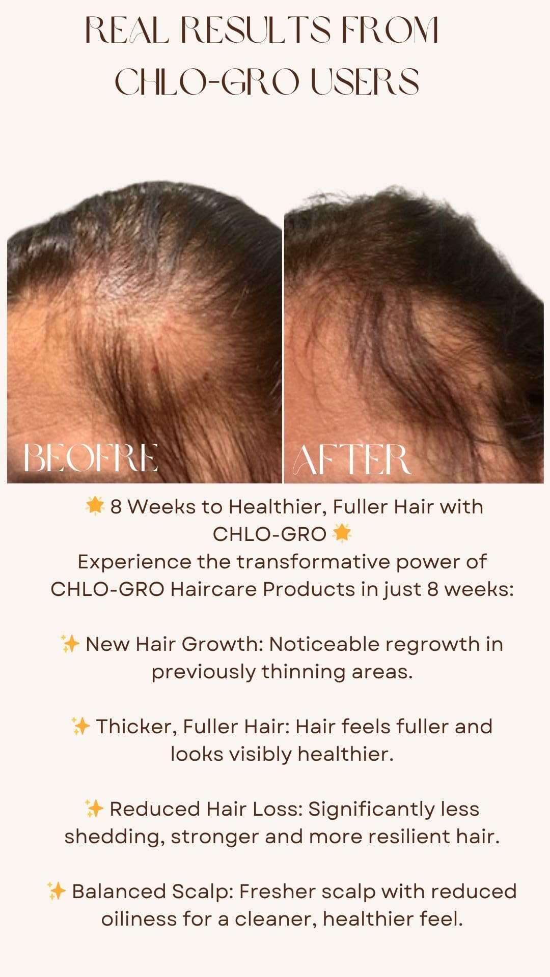 CHLOPURE CHLO-GRO Hair Elixir - Hair Growth Serum, Promotes Thicker, Fuller Growth, Natural Scalp Serum for Men & Women with Argan Oil, Panthenol & Vanilla Extract - 100ml