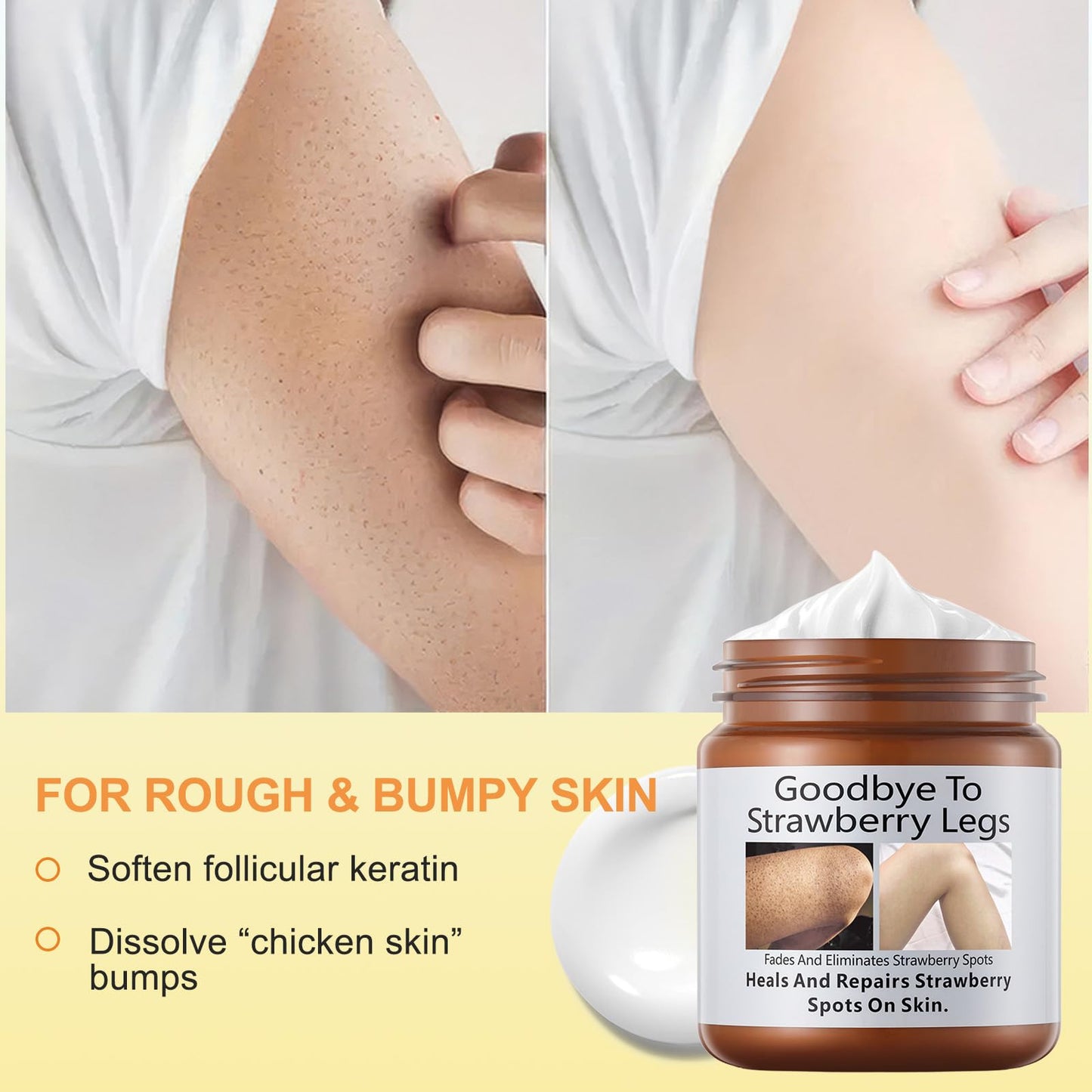 Pothenika Strawberry Legs Treatment Cream, Keratosis Pilaris Treatment, Anti Winkle Smoothing Face Body Moisturiser, Deep Nourishment Skin Exfoliating Repair Cream Fades Strawberry Skin,120g