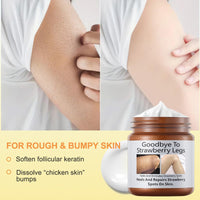 Pothenika Strawberry Legs Treatment Cream, Keratosis Pilaris Treatment, Anti Winkle Smoothing Face Body Moisturiser, Deep Nourishment Skin Exfoliating Repair Cream Fades Strawberry Skin,120g