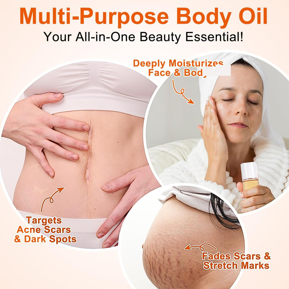 IZBEAUVO Body Skin Care Oil, Stretch Mark & Scar Oil for Women, Stretch Marks Removal Skin Regenerating Body oils, Skin Regenerate oil with Chamomile, Vitamin E, Lavender Improves Elasticity 125ML