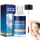 Yoowan Skin Ta/g Removal Serum,Fast-Acting & Painless Wa-Rt Remover,Wa-Rt Remover For Hands,Natural Plant Extract,Ta/g Dry&Fall Away Naturally Suitable For All Skin Types,Removal Of War-Ts On Back,Hands,Face
