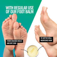 Natural Foot Balm for Cracked Heels and Dry Feet. Tea Tree and Mint. 45ml | Natural, Antibacterial and Moisturising Foot Care. Hydrating Foot and Heel Balm Treatment. By Our Tiny Bees.