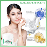 MINSHZEE Scar Removal Cream for Face & Body - Treatment for New Scars, Stretch Marks, Acne Spots & C-Sections Treatment Cream, 50g, Natural Formula for Face and Body, Reduces Old and New Scars