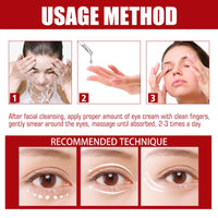 Orknglowy Milia Remover, Milia Spot Serum for Face, Milia Spot Serum Helps to Ruduce Milia, Milia Remover Cream for Women & Men, Anti Aging Anti Wrinkle, Reduces Bags, Saggy Skin & Puffy Eyes