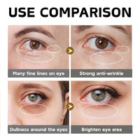 Cureluxe Pack of 3 Micro Needle Patches - Dissolving Microneedle Eye Patches with Vitamin E,Collagen,Hyaluronic Acid - Anti-Wrinkle Microneedle Patches - Collagen Eye Patches for Dark Circles & Puffy Eyes