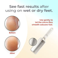 Microplane Colossal Pedicure Rasp Foot File - White by Microplane