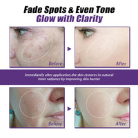 Katslyn Skin Tightening Cream for Face