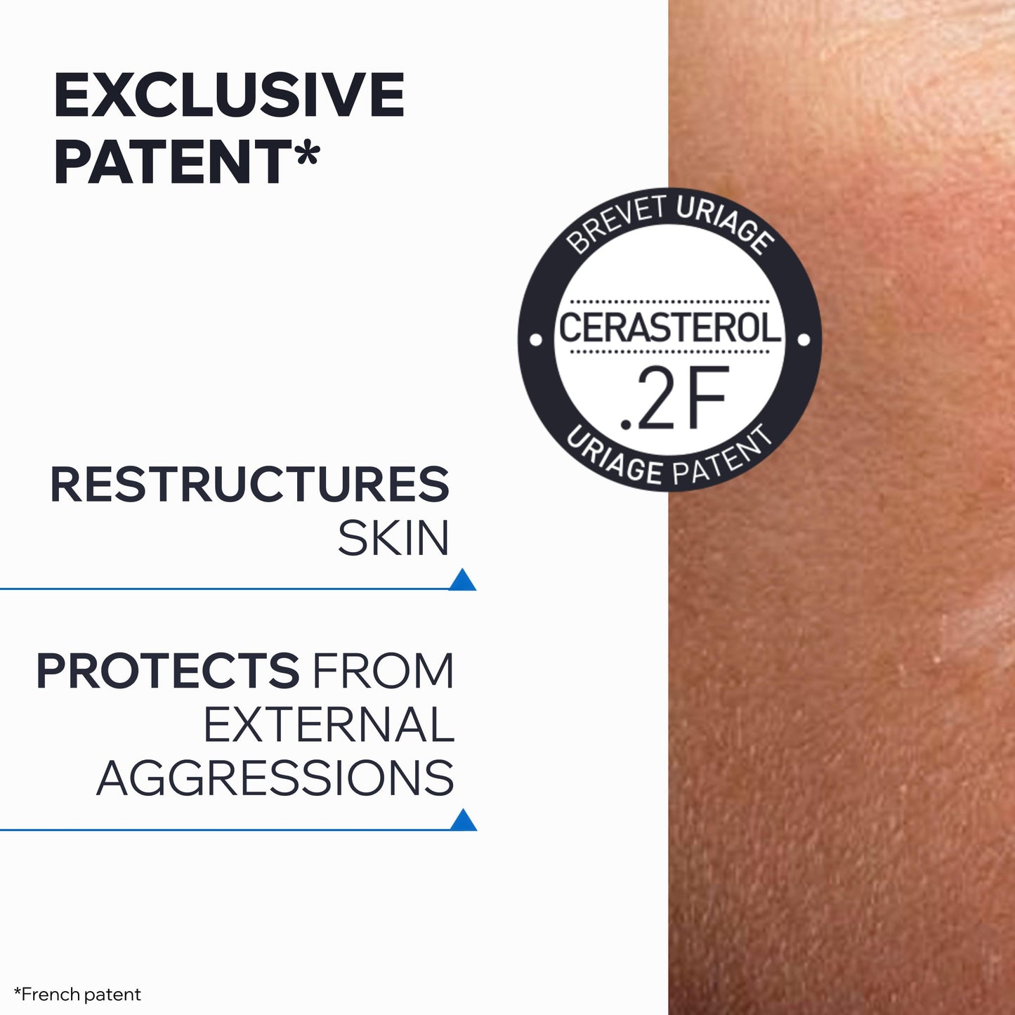 Uriage Keratosane 30 - Concentrated Gel-Cream for Rough, Bumpy Skin, Ingrown Hairs, Keratosis Pilaris - 30% Urea - Fragrance-Free - 40ml