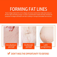 Stretch Mark Treatment Oil for Women - Optimal Formula for Removal of Stretch Marks, Scars, Firming & Lifting Body Care, 50ml