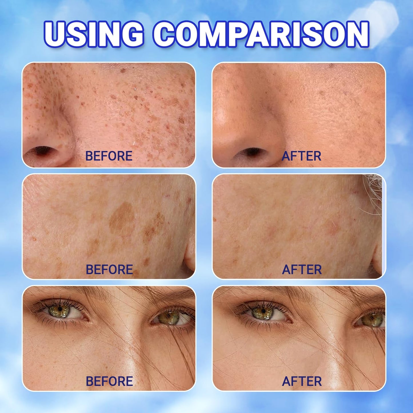 GMHLLES 2 Bottles Urea Cream 60 Percent for Feet,70g Cracked Heel Repair Cream,Urea Moisturiser,Lightweight and Gentle,Suitable for Cracked Feet and Dry Body Skin Care,with 1 Massage Board