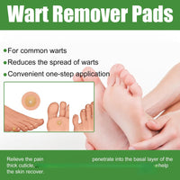 ShengQiu 30pcs Wart Remover,Verruca Treatment,Wart Remover for Hands,Plantar Wart R/emover for Feet,Effective Deep Verruca R/emoval Pads Patches for Adults