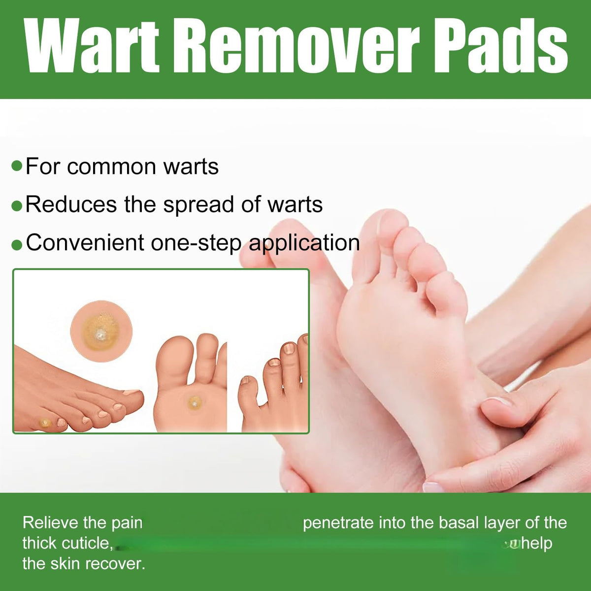 ShengQiu 30pcs Wart Remover,Verruca Treatment,Wart Remover for Hands,Plantar Wart R/emover for Feet,Effective Deep Verruca R/emoval Pads Patches for Adults