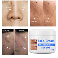 GNAUMORE Dark Spot Corrector Cream,Sun Spots and Melasma Freckle Remover,Spot Remover For Face Serum,Moisturizing Removes Facial Melasma Dark Spots Wrinkles Blemishes 50G