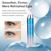 VRAIKO Eye Serum for Dark Circles and Puffiness, 5% Caffeine 8% Retinol Under Eye Cream with Build-In 3D Roller Applicator, Hyaluronic Acid Peptide for Hydration Fine lines Wrinkles, 0.5 fl oz
