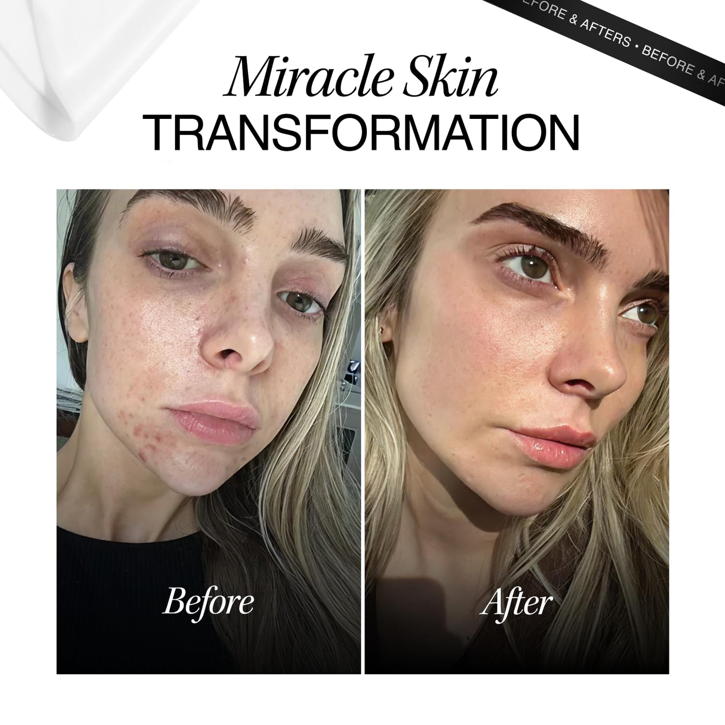 cosmeticconsult Cosmetic Consult Miracle Skin Transformation By Ashley Stobart | Rejuvenates & Refreshes Skin Overnight, Smooths Wrinkles & Acne, Boosts Collagen, Anti-Ageing Skin Cleanser | 4 x Skincare Sachets
