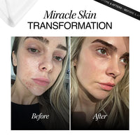 cosmeticconsult Cosmetic Consult Miracle Skin Transformation By Ashley Stobart | Rejuvenates & Refreshes Skin Overnight, Smooths Wrinkles & Acne, Boosts Collagen, Anti-Ageing Skin Cleanser | 4 x Skincare Sachets