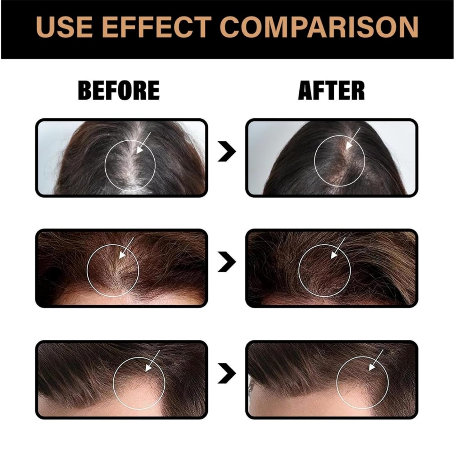 Haiyox Root Activator Shampoo,Mane Shampoo For Men,Mane Root Activator Sh-ampoo For Men,Root Activator Sh-ampoo,Repairs Smooths Strengthens Hair,Natural Essence Hair Growing Sha-mpoo(1pc)