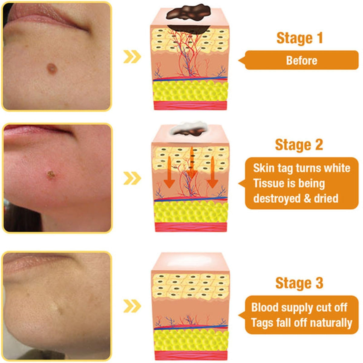 DEJIN 2 Pcs Bee Venom Skin Treatment Cream, Professional Repair and Moisturizing Gel, Hydrating New Formula for All Skin Types