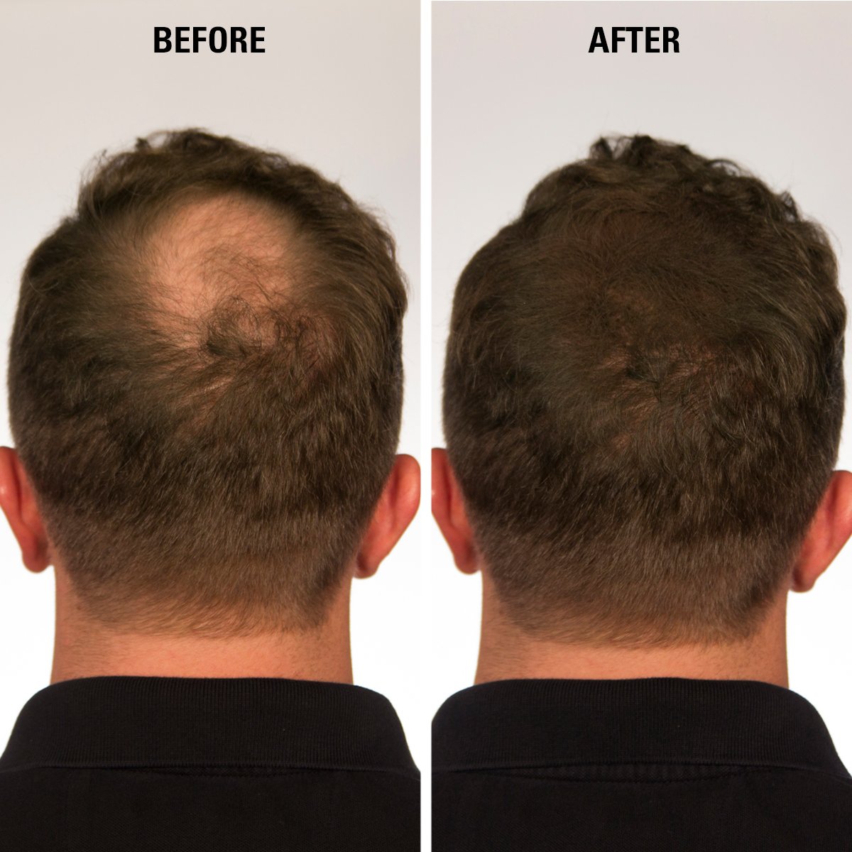 Infinity Hair Building Fibers To Conceal Thinning For The Appearance Of Thicker, Fuller Women & Men - Auburn 28G