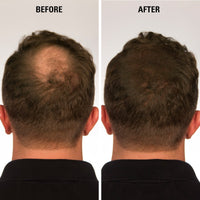 Infinity Hair Building Fibers To Conceal Thinning For The Appearance Of Thicker, Fuller Women & Men - Auburn 28G