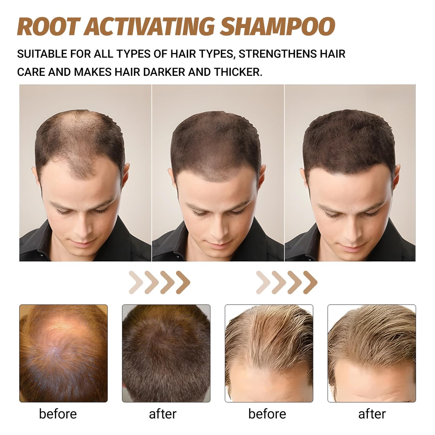 Neyeau Hair Loss Shampoo,Natural Mane Root Activator Shampoo for Men,Nourishing,Repair,Smooth and Strengthen Hair,Unisex,with 1 Nourishing Conditioner
