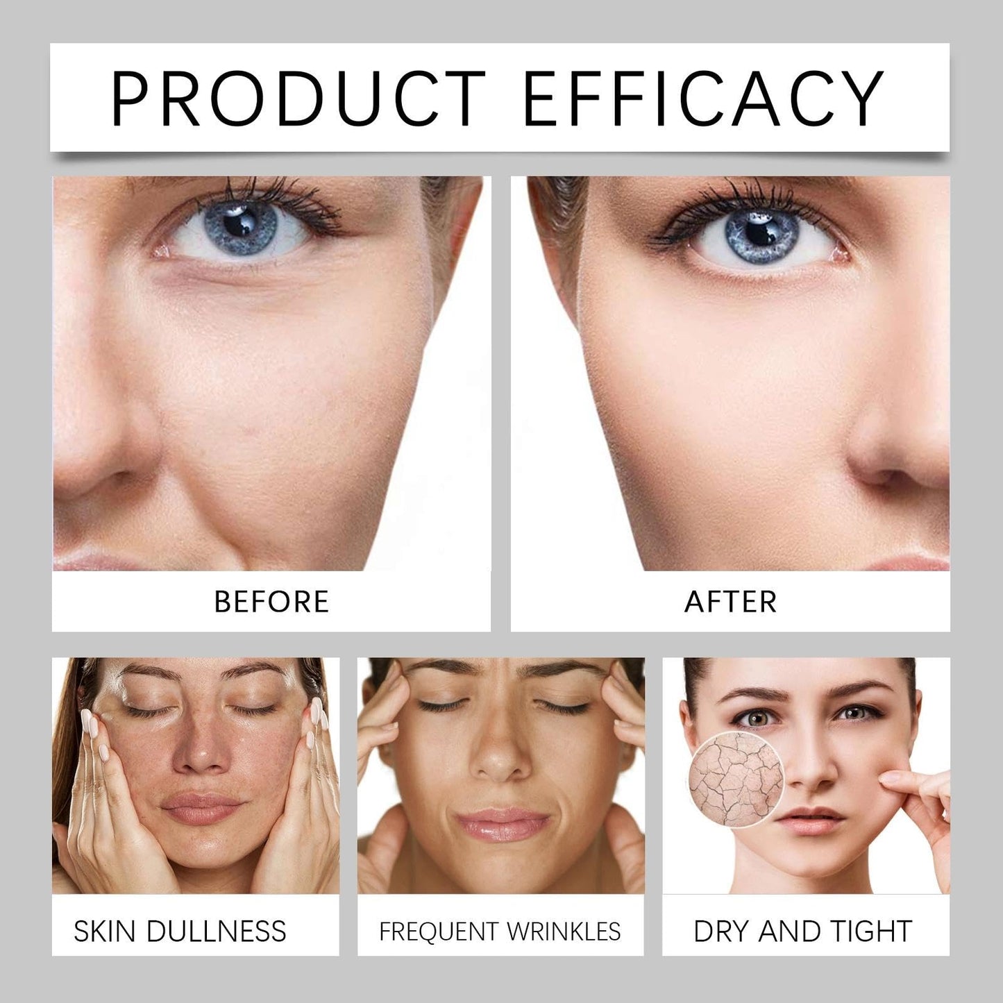 Maggikey Bee Venom Anti - Wrinkle Face Cream For Women. A Day And Night Moisturizer Suitable For All Skin Types. Helps, Targets The Look Of Wrinkles & Fine Lines