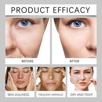 Maggikey Bee Venom Anti - Wrinkle Face Cream For Women. A Day And Night Moisturizer Suitable For All Skin Types. Helps, Targets The Look Of Wrinkles & Fine Lines