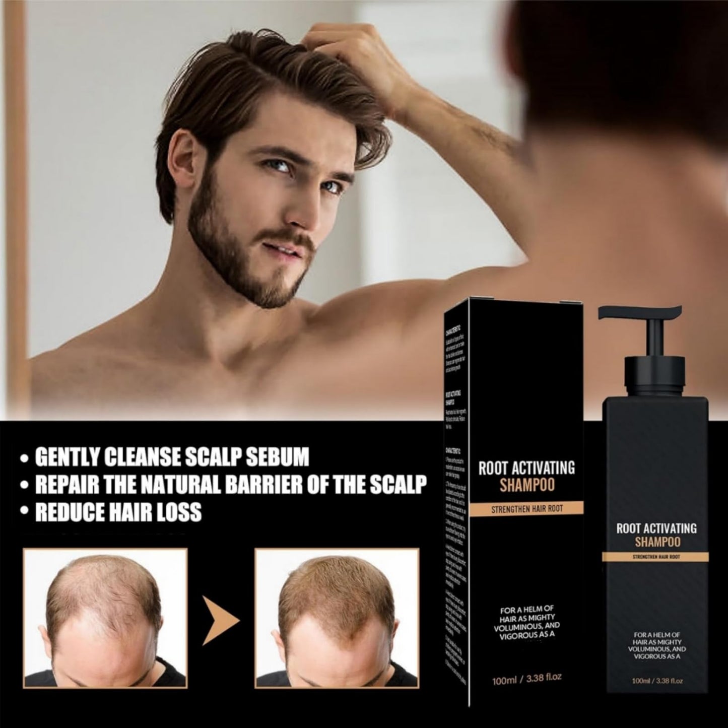 Haiyox Root Activator Shampoo,Mane Shampoo For Men,Mane Root Activator Sh-ampoo For Men,Root Activator Sh-ampoo,Repairs Smooths Strengthens Hair,Natural Essence Hair Growing Sha-mpoo(1pc)