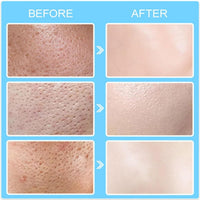 Heefeng Pore Shrinking Invisibility Filler Primer,Pore Minimizer Primer,Pores Reducer For Face,With Hyaluronic Acid,Smooths Conceals,Blurring Poreless Face Primers,Oil-Control,For All-Day Wear Makeup,50g