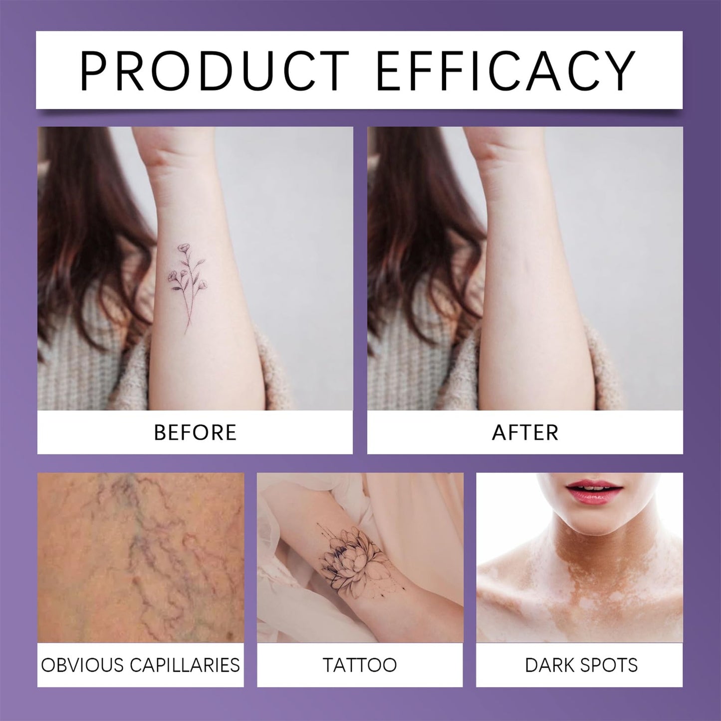 SHEBEEDO Tattoo Cover Up Makeup, Leg Makeup to Cover Veins,Body Makeup for Legs Natural Gloss Waterproof No Transfer for Tattoo Cover Up Long Last,Body Coverage Perfector 2.5 Oz (Natural Radiance)