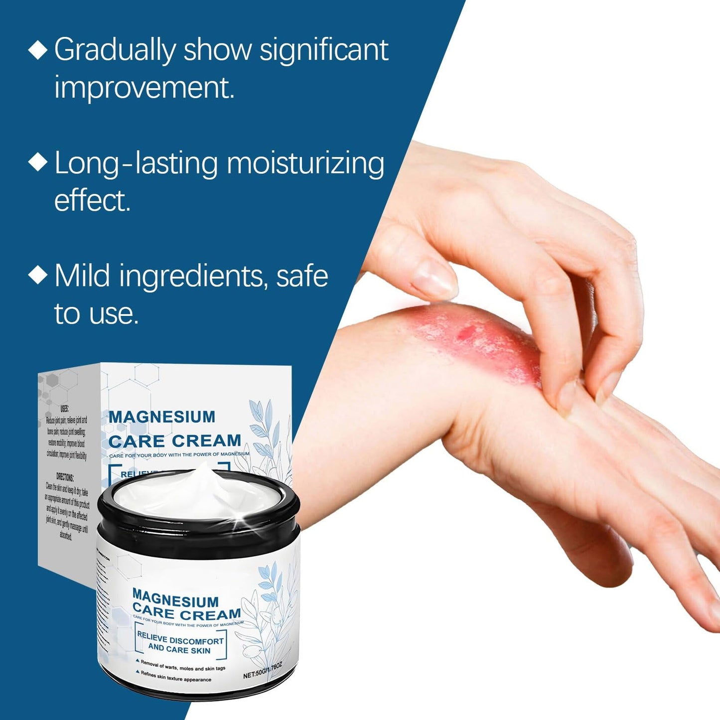 Magnesium Cream, Skin Treatment Cream, Gentle Repair Care, Effective joint Relief Pa-in for Whole Body, Highly Concentrated Magnesium for All Skin Types
