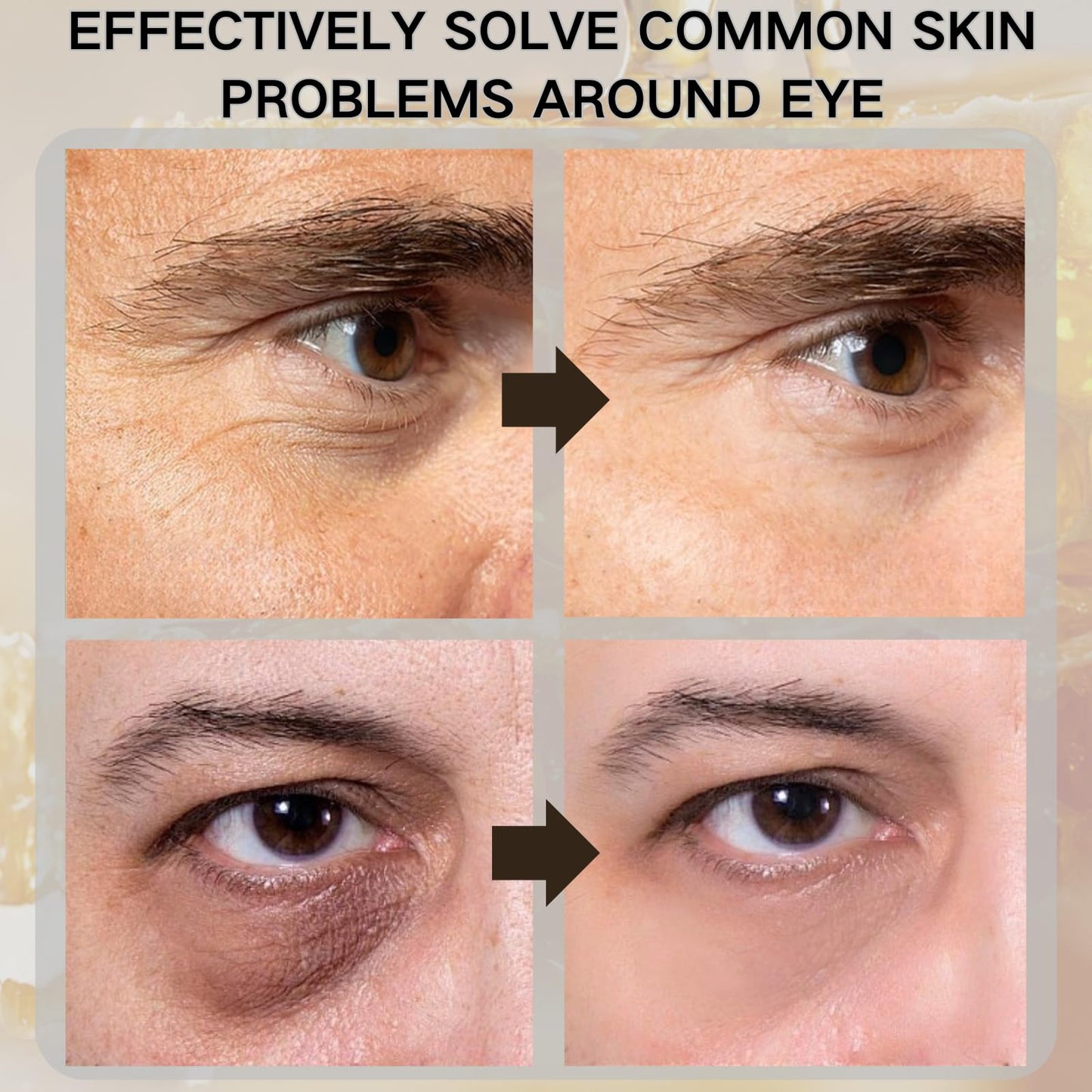 TBeautfave Mens Bee Venom Peptide Eye Cream, Under Eye Cream for Dark Circles & Puffiness - Eye Bag Remover, Puffy Eye Treatment for Men, Anti Aging E ye Cr eam, Wrinkle Filler, Hydrating, Firming