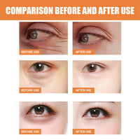 Generic Vitamin C Eye Cream Stick, Glow Eye Stick for Dark Circles and Puffy Eyes, Under Eye Balm for Women and Men, Cooling Moisturizing Formula for a Younger Look