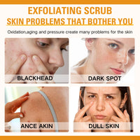 Trendyfave Orange Face Exfoliator, Vitamin C Face Scrub, Mild Exfoliating Face Wash, Orange Exfoliating Gel For Brightening Skin, Exfoliating Scrub Remove Dead Skin For Smooth & Radiant - Face & Body &Knee