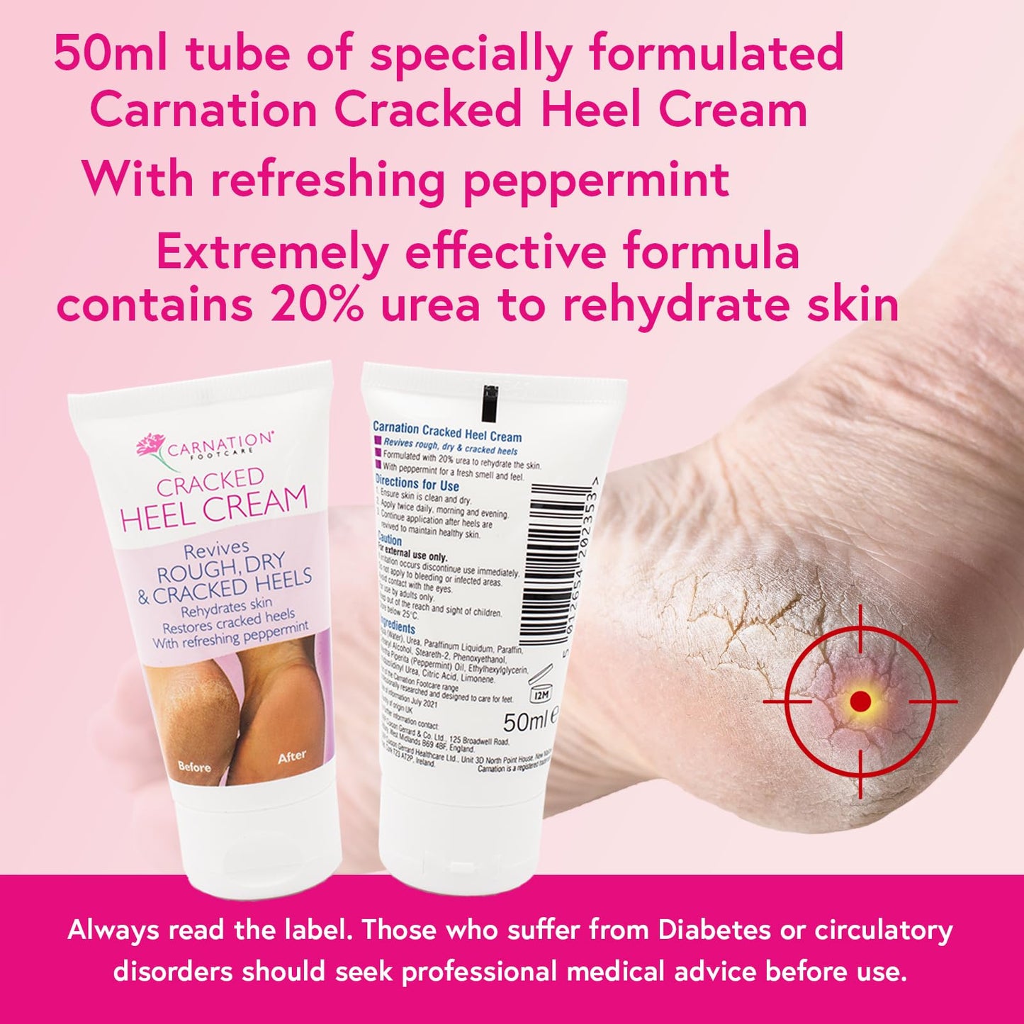 CARNATION FOOTCARE Cracked Heel Cream, Revives Rough, Dry and Cracked Heels, Moisturises, Rehydrates Dry Callused Feet with Refreshing Peppermint Oil with 20% Urea, 50ml