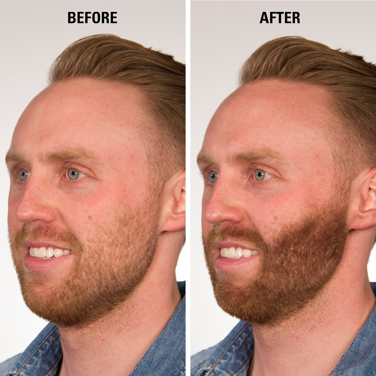 Infinity Hair Building Fibers To Conceal Thinning For The Appearance Of Thicker, Fuller Women & Men - Auburn 28G