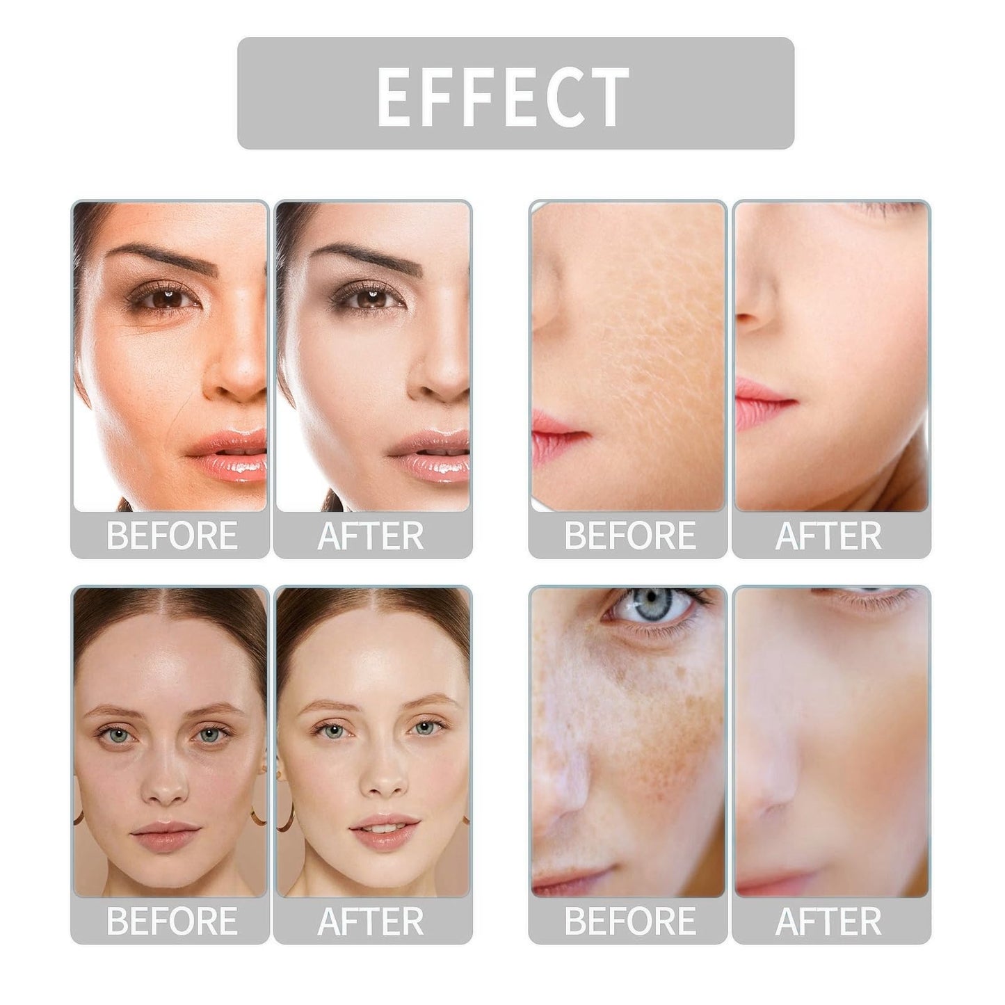 BigyQiu Rose Vitamin E Oil,Rose Vitamin E Face & Body Oil,Natural Rose Essential Oil for Scars,Rosehip Oil for Face,Body Oil for Dry Skin,Face Oil Anti-Ageing,Pure Vitamin E Oil,Reduces Fine Lines and Winkles