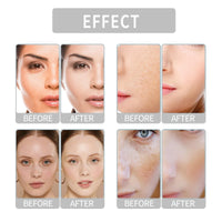 BigyQiu Rose Vitamin E Oil,Rose Vitamin E Face & Body Oil,Natural Rose Essential Oil for Scars,Rosehip Oil for Face,Body Oil for Dry Skin,Face Oil Anti-Ageing,Pure Vitamin E Oil,Reduces Fine Lines and Winkles