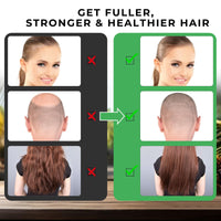 Go Ho Raw Batana Oil for Hair Growth,100% Pure Batana Oil Organic Dr. Sebi,Rich in Vitamin E, Increases Shine,Scalp and Hair Care for Women&Men,Prevent Hair Loss(120g)