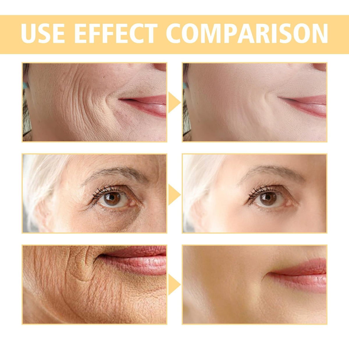 Siyinzu Bee Venom Wrinkle Removal Cream,Bee Venom Anti Aging Face Cream,Bee Venom Cream,Skin Tightening Creams for Face,Firming Face Serum for Women,Bee Venom Skin Treatment Serum,Face Cream for Mature