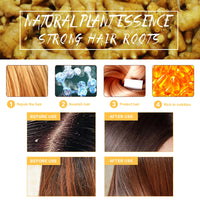 Samkeen Ginger Hair Shampoo Bar, Ginger Shampoo Bar, Ginger Shampoo Soap, Natural Organic Ginger Shampoo Soap for All Hair Types, Moisturize Hair and Control Oil (2pcs Ginger)