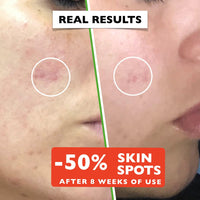 Big 2.11oz. Organic Vitamin C Serum for Face with Hyaluronic Acid. Anti-Aging, Wrinkles, Dark Spots, Brightening and Vegan. Facial Skin Care. Eye Cream Suitable. Women and Men