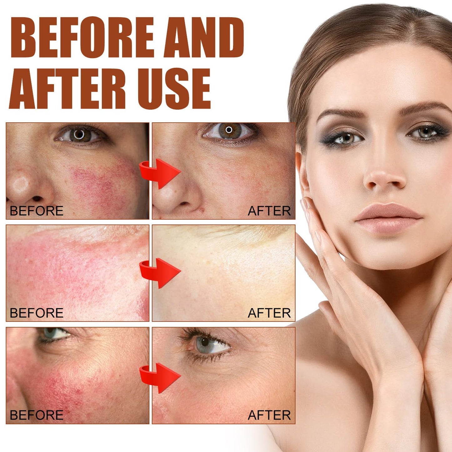 DMQ 2PCS Rosacea Face Serum,Anti Redness Face Serum,Tea Tree Anti Aging Serum for Face,Relieve Redness & Acne Mark,Natural Face Moisturizer for Sensitive Skin,Improve Skin Elasticity-Women & Men