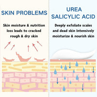 60% Urea Cream - Cracked Heel Repair Cream - Urea Foot Cream with Salicylic Acid, Aloe Vera- Foot Cream for Cracked Heels and Dry Skin - Skin Care for Foot Moisturiser (3PCS)