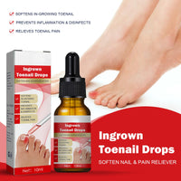 Fashion Base Ingrown Toenail Treatment Drop - Ingrown Toenail Treatment- Cuticle Care Oils for Ingrown Toenails - Trimming Toenail Softening Drops Natural Ingrown Toenail Correction Fungal Nail - 10ml
